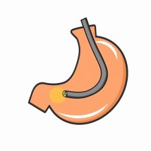 胃カメラ・大腸内視鏡検査の同日検査が可能