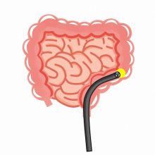 胃カメラ・大腸カメラの同日検査が可能